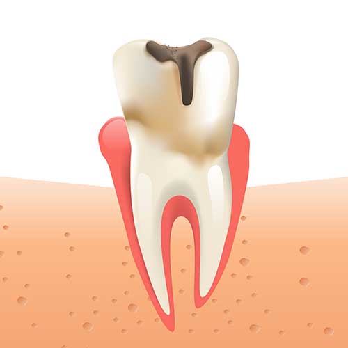 A diagram showing the cross-section of a tooth with roots